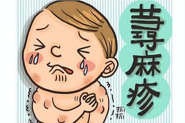 荨麻疹症状是什么？饮食少吃6食物原因、治疗一次看J9九游会 九游会J9(图4)
