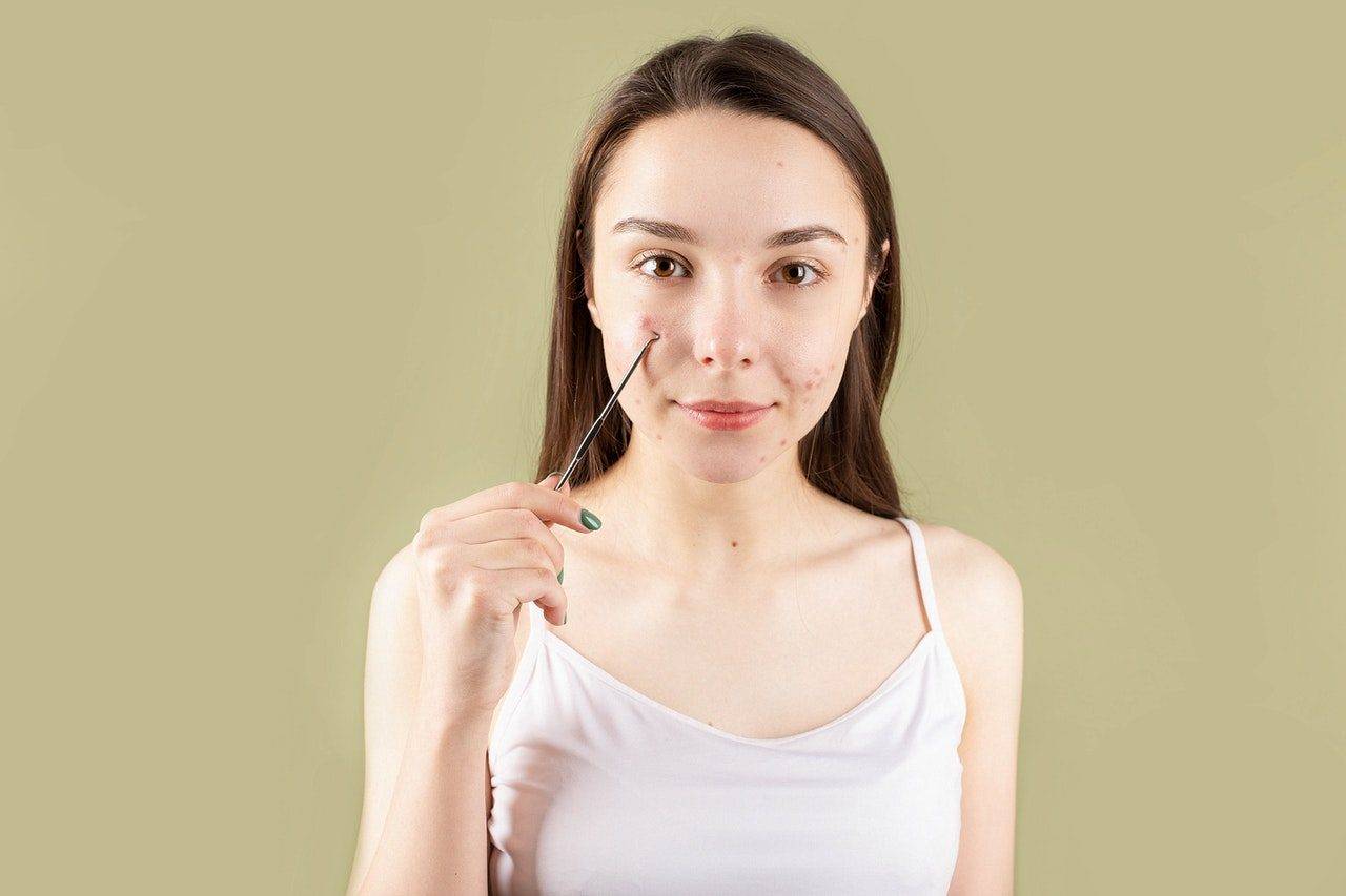 九游会J9 J9九游会湿疹与你的饮食有关吗？哪些该吃哪些不该吃？(图3)